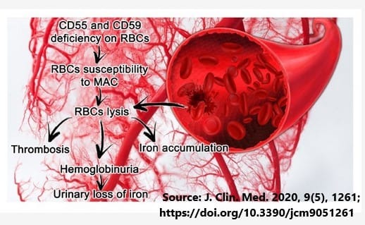 Roche's Paroxysmal Nocturnal Hemoglobinuria Treatment Has EU Approval